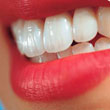 سفیدکننده دندان White Light